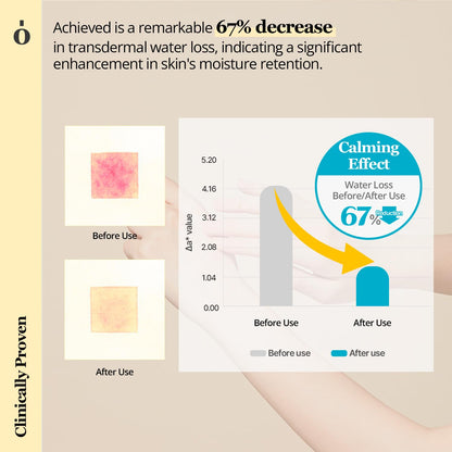 ONGREDIENTS - Skin Barrier Calming Lotion [220ml]