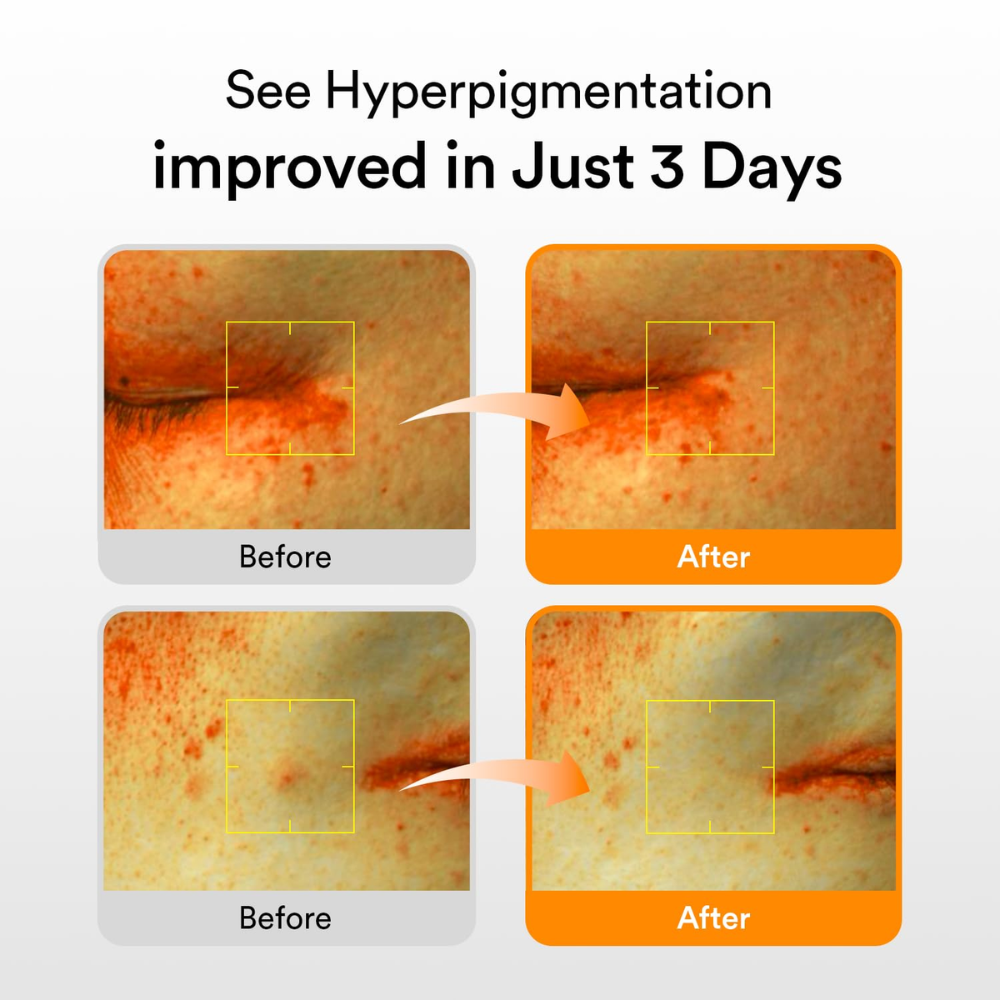 ABIB - Glutathiosome Dark Spot Serum Vita Drop [50ml]