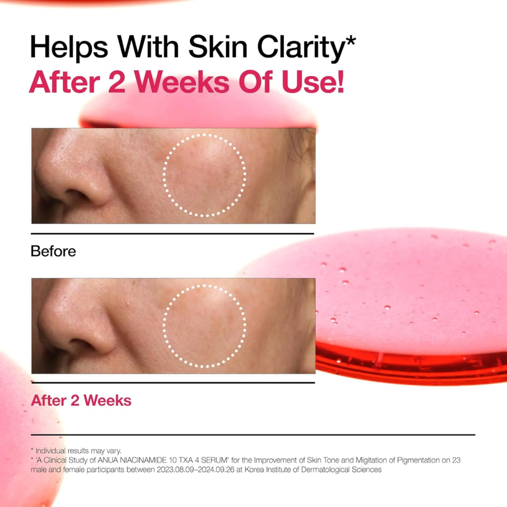 ANUA - Niacinamide 10% + TXA 4% Serum [30ml]