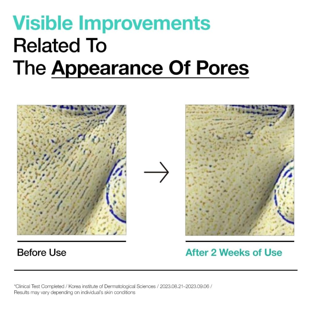 ANUA - BHA 2% Gentle Exfoliating Toner [150ml]