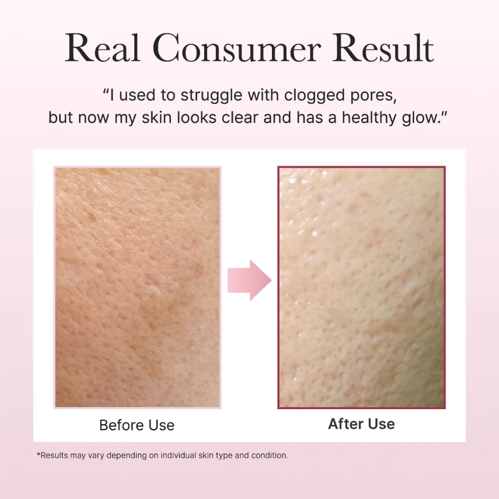 ARENCIA - Fresh Rosehip Rice Mochi Cleanser [120g]