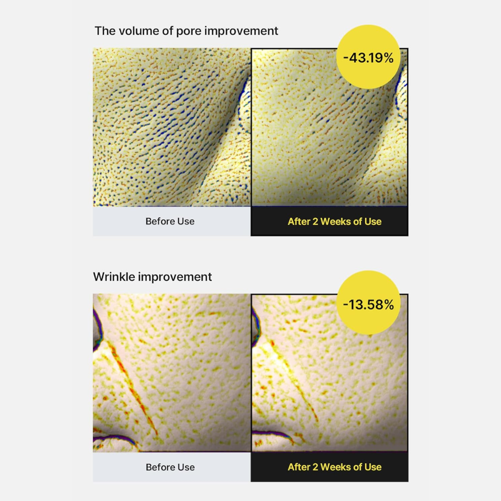 CELIMAX - The Vita-A Retinol Shot Tightening Serum [30ml]