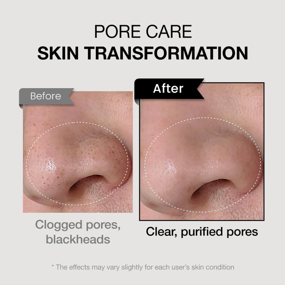 COXIR - TXA Mucin Pore Mask Cleanser [120ml]