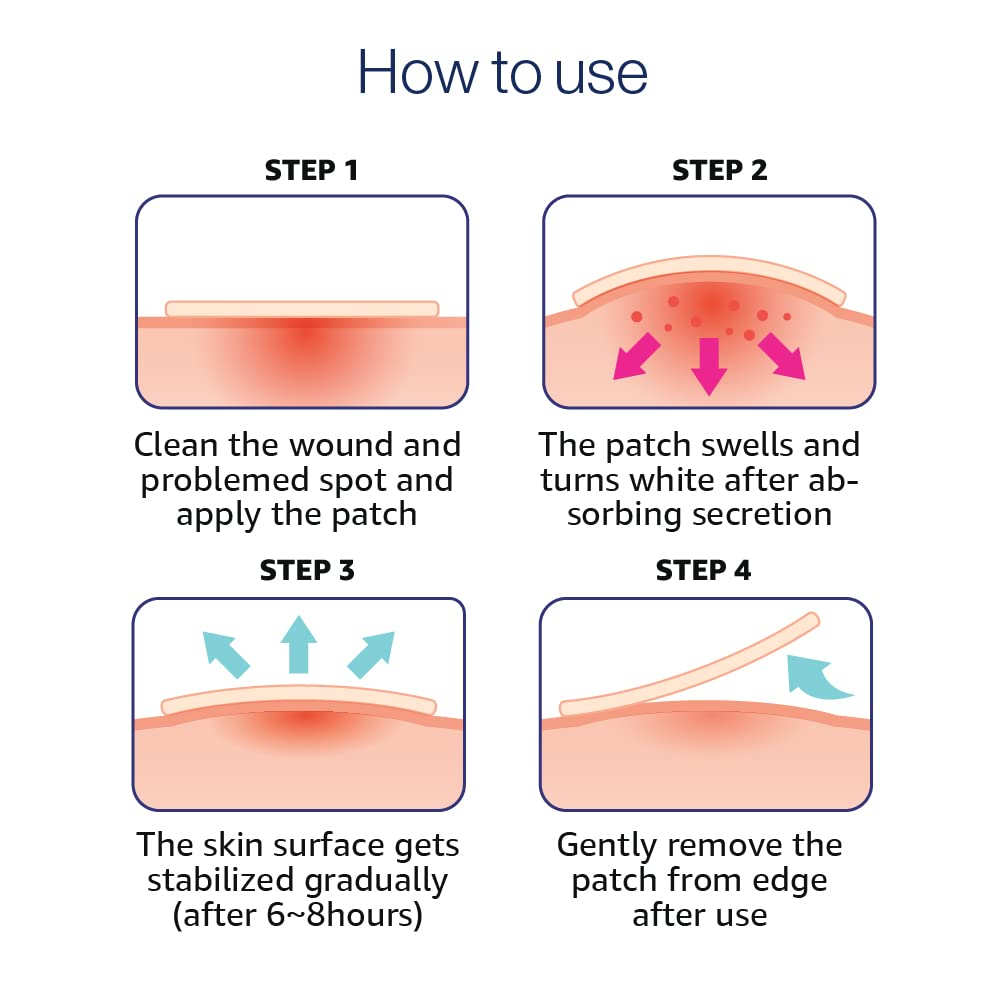 CARE PLUS - Scar Cover Spot Patch [102pcs]