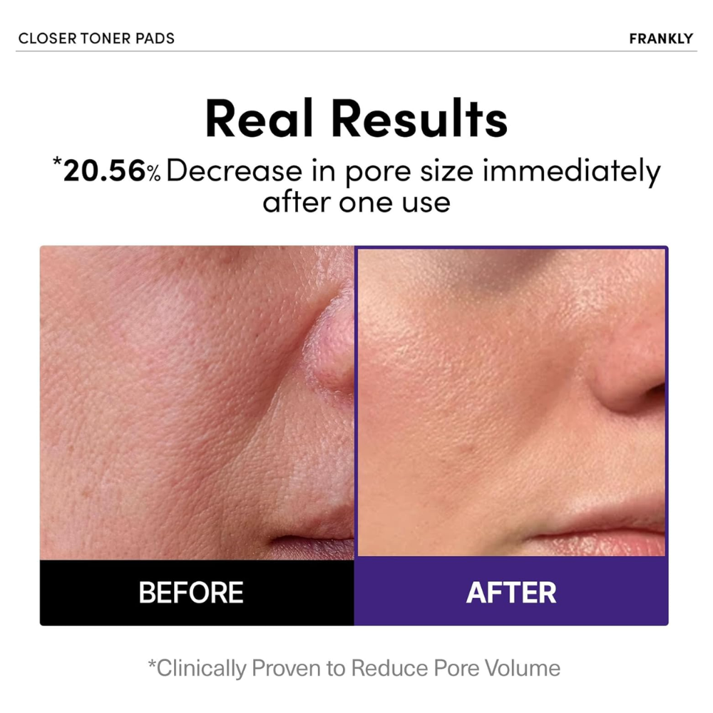 FRANKLY - Closer Pore Tightening Toner Pads [70 pads]