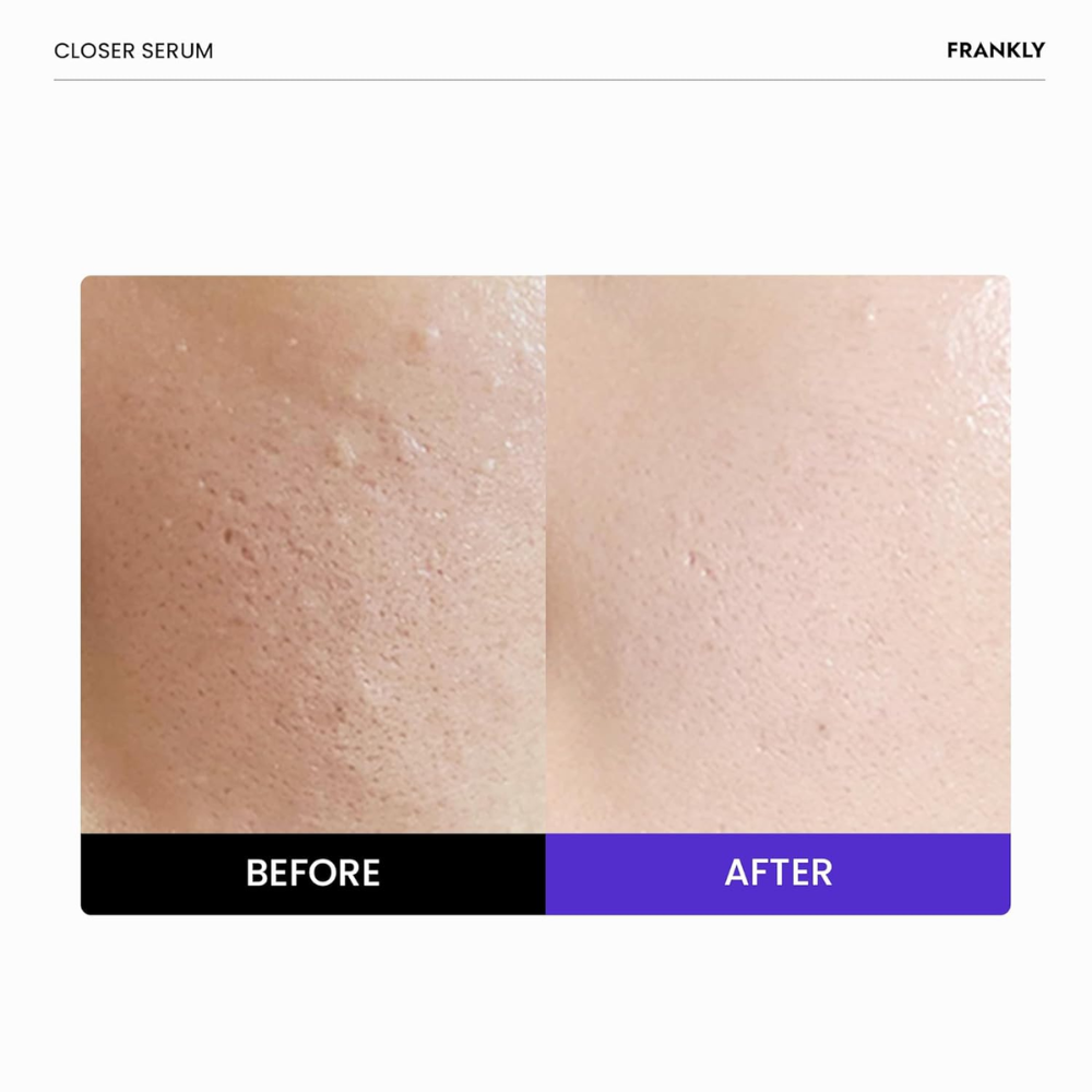 FRANKLY - Closer Pore Reducing Serum [30ml]