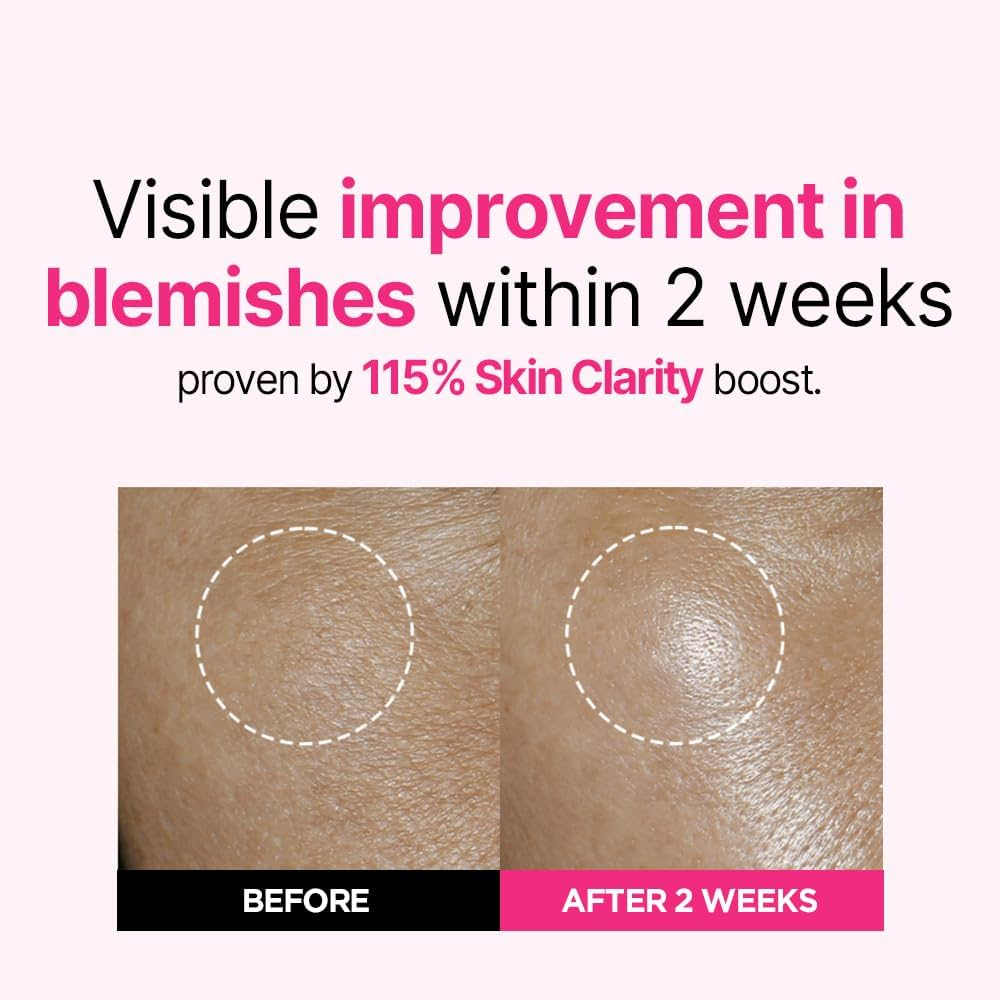 ISOI - Bulgarian Rose Blemish Care Up Serum [35ml]