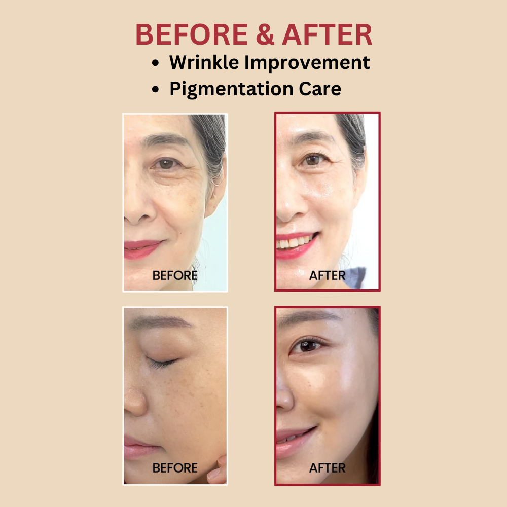 KSECRET - SEOUL 1988 Serum : Retinal Liposome 2% + Black Ginseng [30ml]