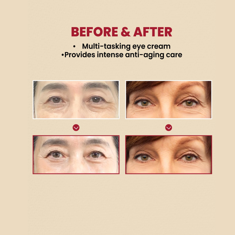 KSECRET - SEOUL 1988 Eye Cream: Retinal Liposome 4%+Fermented Bean [30ml]