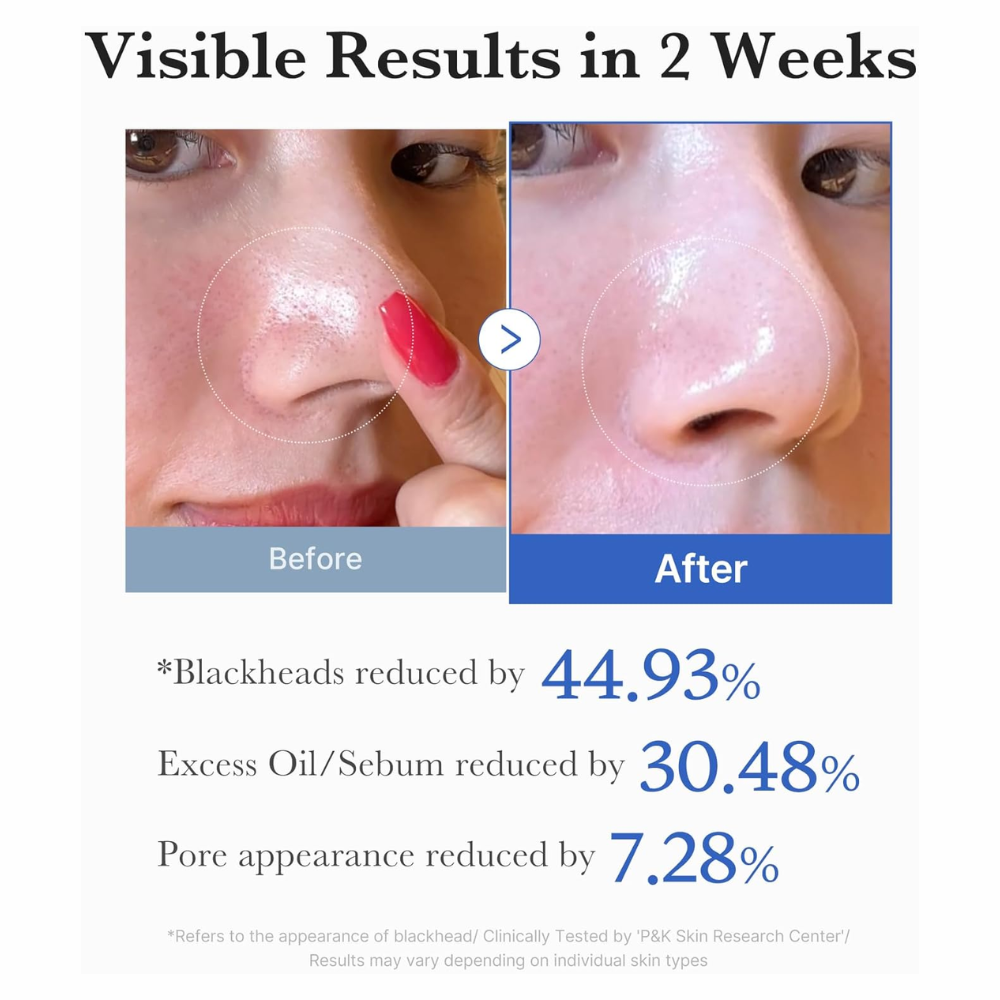 MEDICUBE - Zero Pore Pad 2.0 [70 pads]