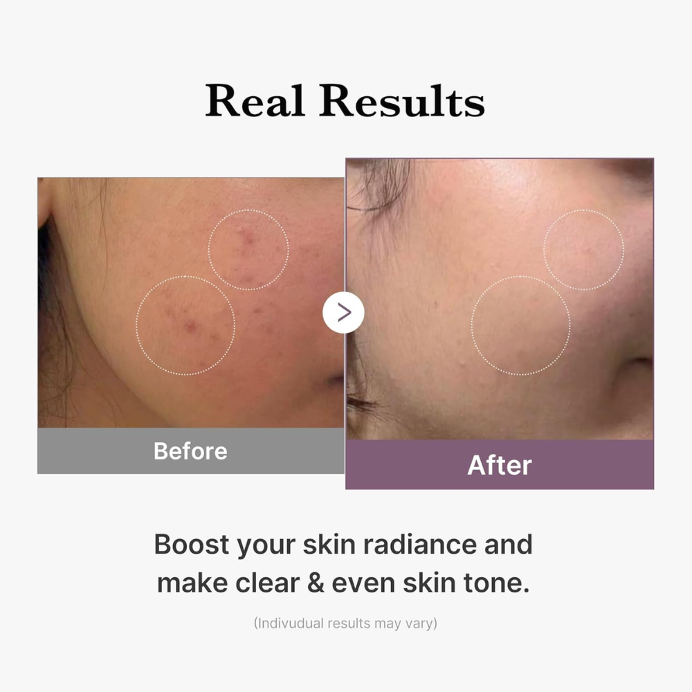 MEDICUBE - AGE-R Glutathione Glow Toner [140ml]