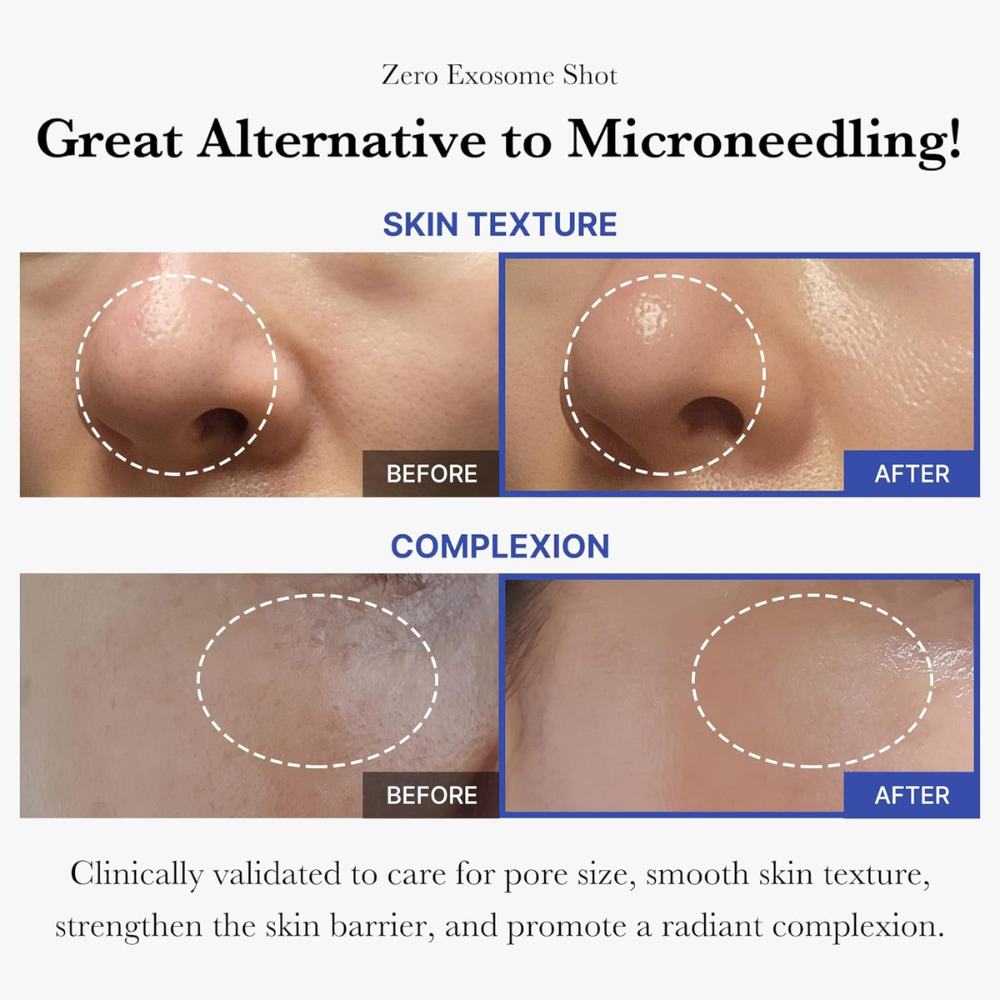 MEDICUBE - One Day Exosome Shot Pore Ampoule 2000 [30ml]