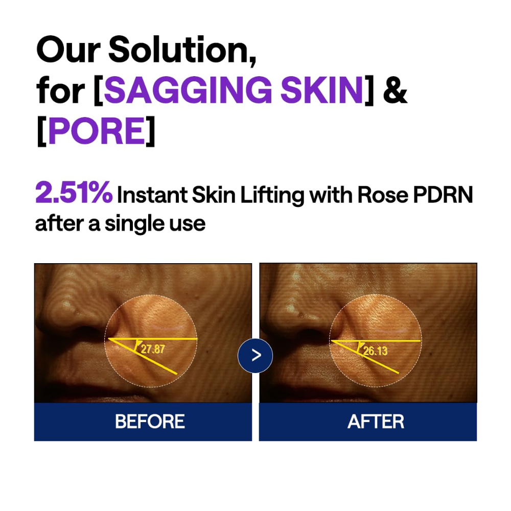 MEDIHEAL - PDRN Lifting Serum [40ml]