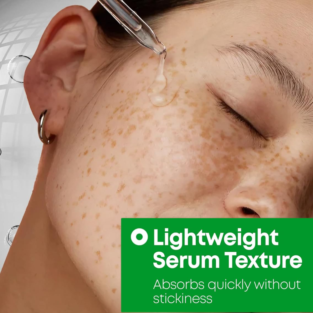 NINELESS - A-Control 10% Azelaic Acid Serum [30ml]