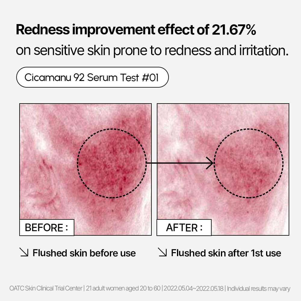 PARNELL - Cicamanu 92 Serum [30ml]