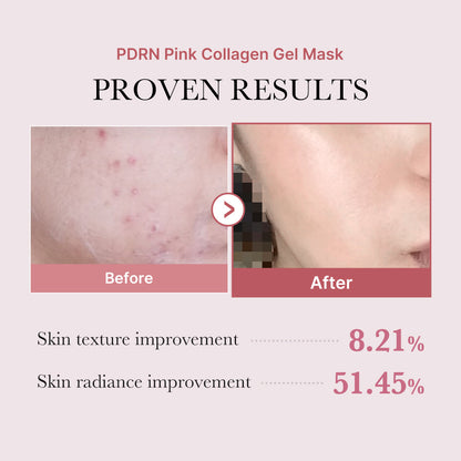 MEDICUBE - PDRN Pink Collagen Gel Mask [28g]