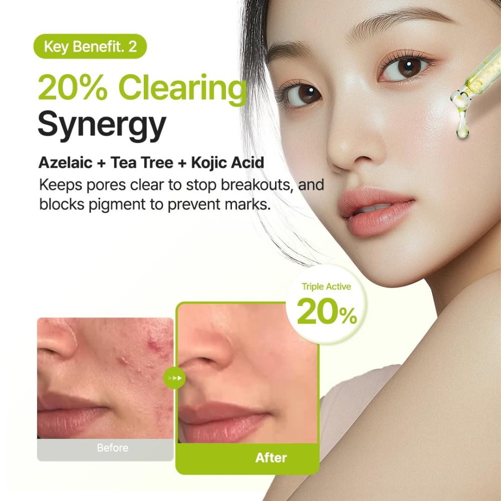 PURITO SEOUL - Azelaic Acid 10 Kojic Tea Tree Serum [30ml]