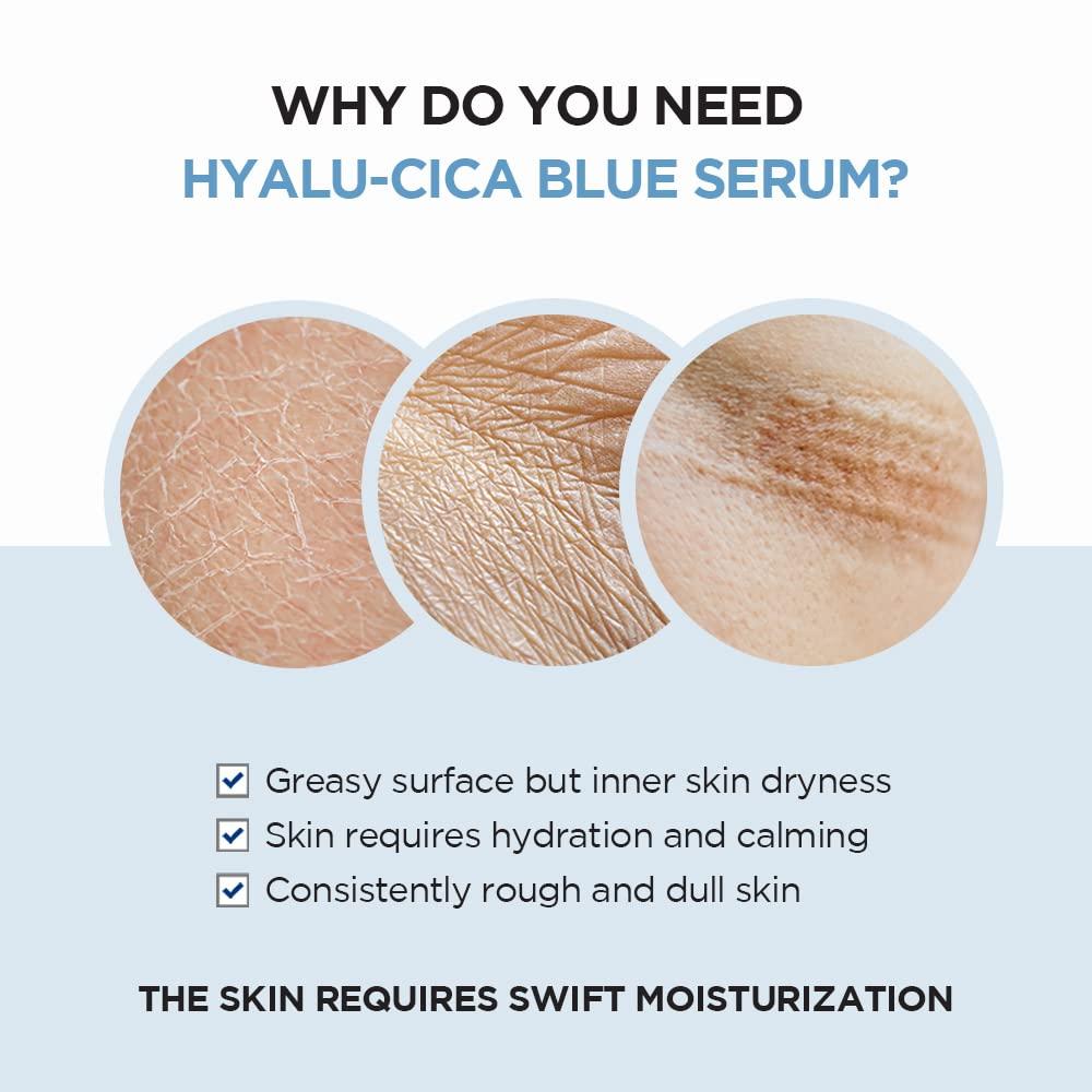 SKIN1004 - Madagascar Centella Hyalu-Cica Blue Serum [50ml]