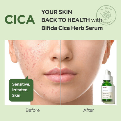 MANYO - Bifida Cica Herb Serum [50ml]