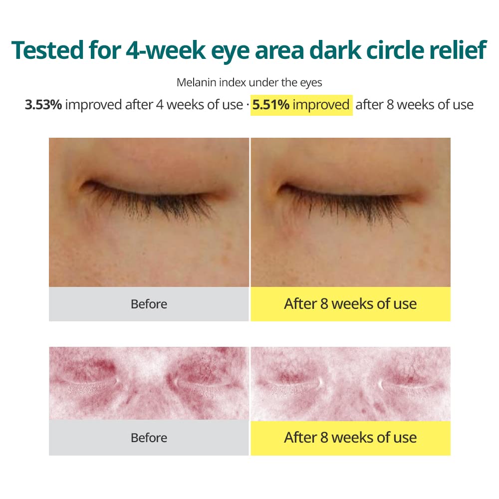 GOODAL - Green Tangerine Vita C Dark Circle Eye Cream [30ml]