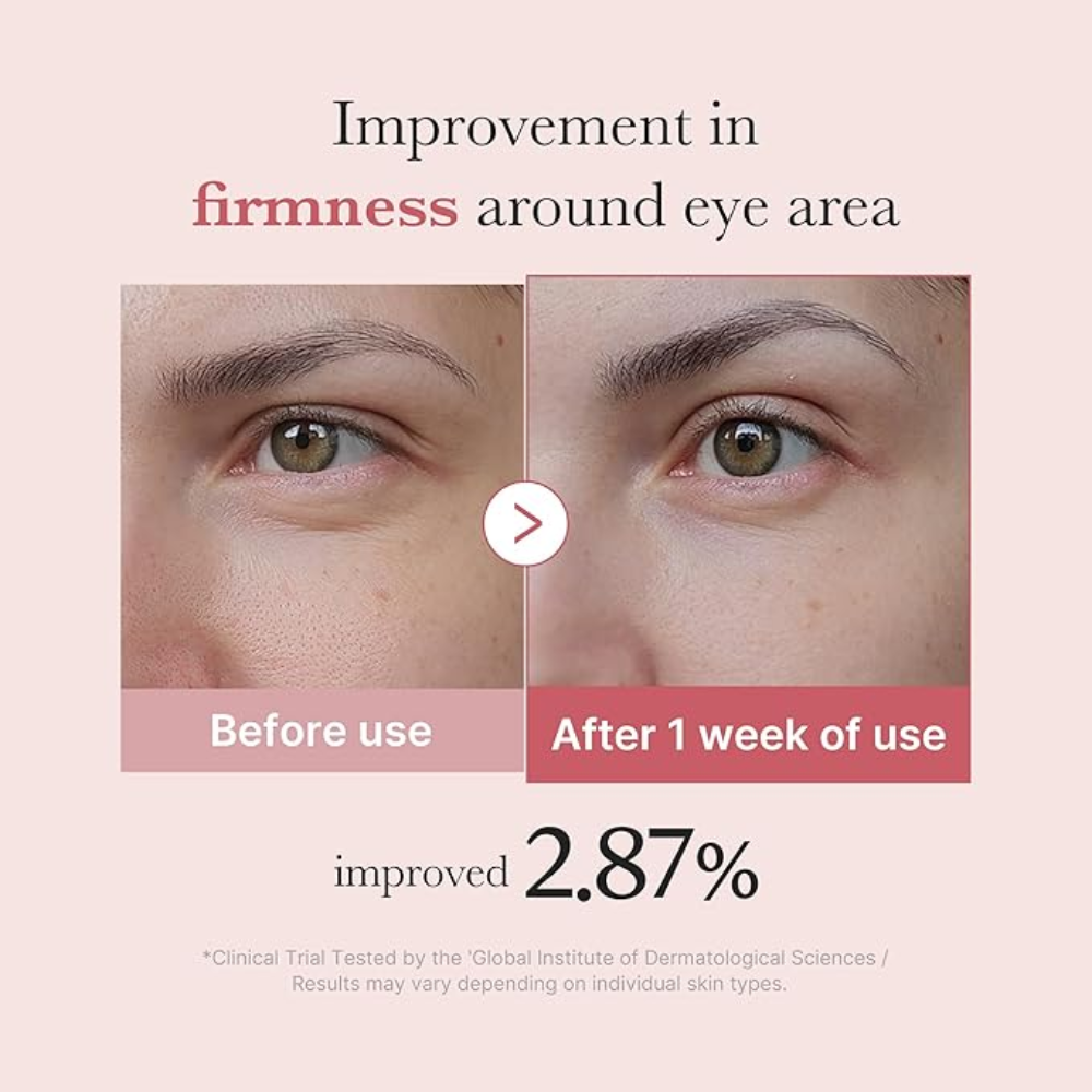 MEDICUBE - PDRN Pink Peptide Eye Cream [30ml]