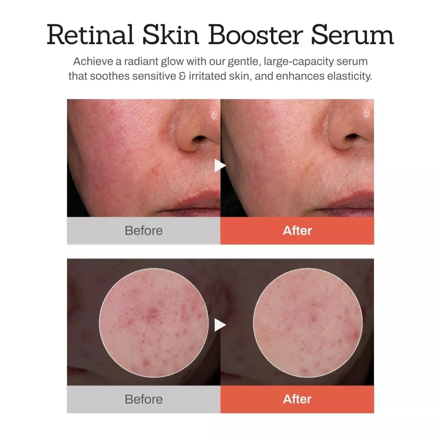 MEDITHERAPY - Retinal Skin Booster Serum [150ml]