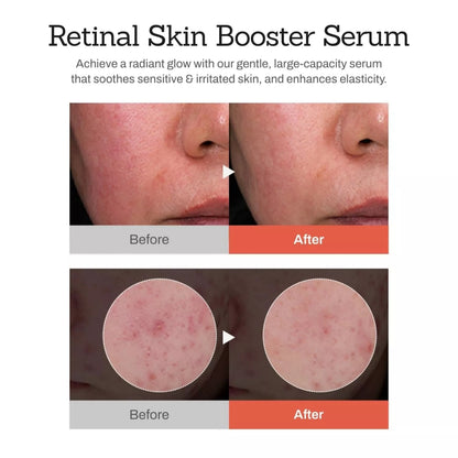 MEDITHERAPY - Retinal Skin Booster Serum [150ml]